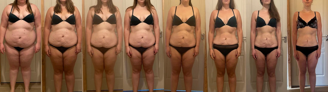 Photo avant après d'une femme qui a fait une grande perte de poids : de 140 à 70 kilos.