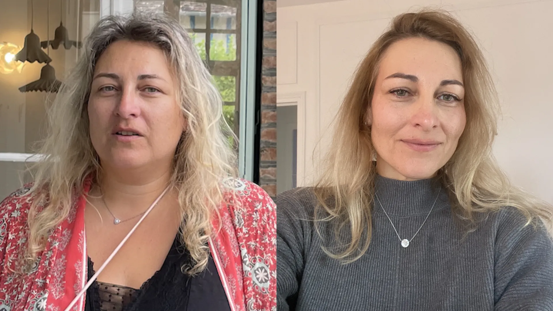 Avant/après du visage d'une femme qui a perdu plus de 50kg dans sa quarantaine. Le résultat est surprenant.
