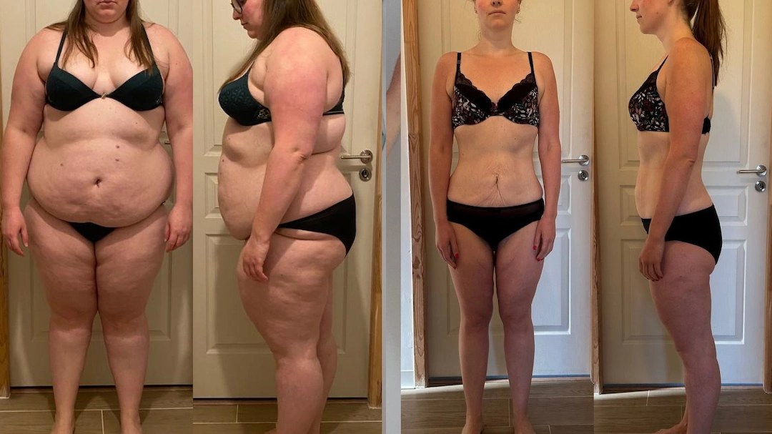 Avant/après d'une femme ayant perdu 60 kilos naturellement, sans chirurgie bariatrique ni relâchement cutané. À gauche, un corps en surpoids, à droite, une silhouette affinée et tonique grâce à une alimentation saine et au sport. Exemple inspirant de transformation physique réussie.