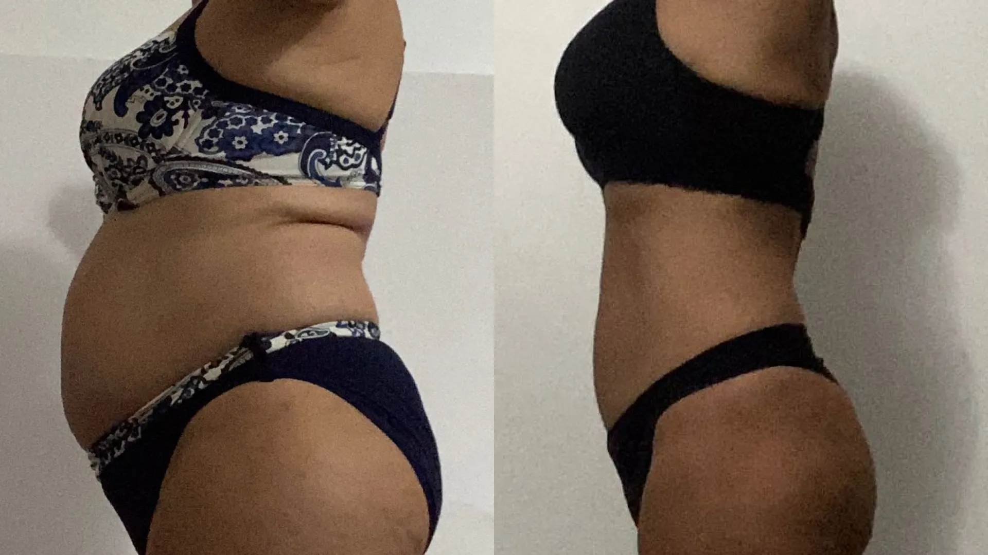 Voici un avant/après de Nathalie, 55 ans, qui a perdu du ventre et des fesses tout en affinant sa taille et sculptant son corps.
