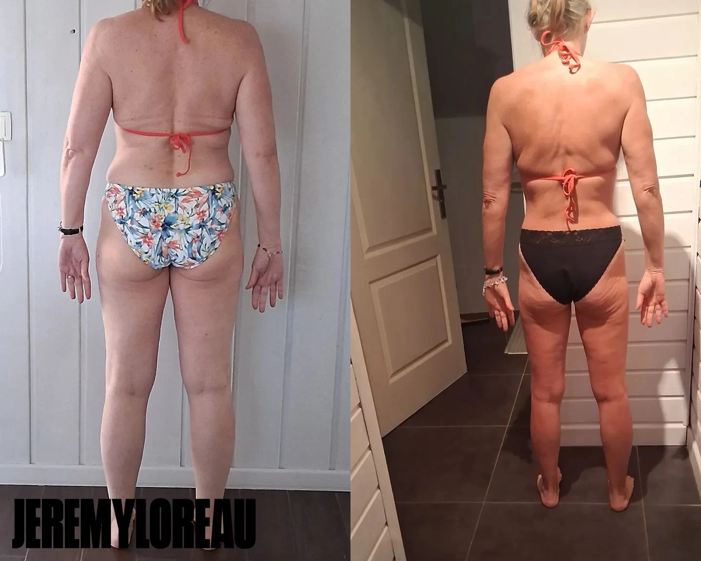 Perte de poids d'une femme de 50 ans.