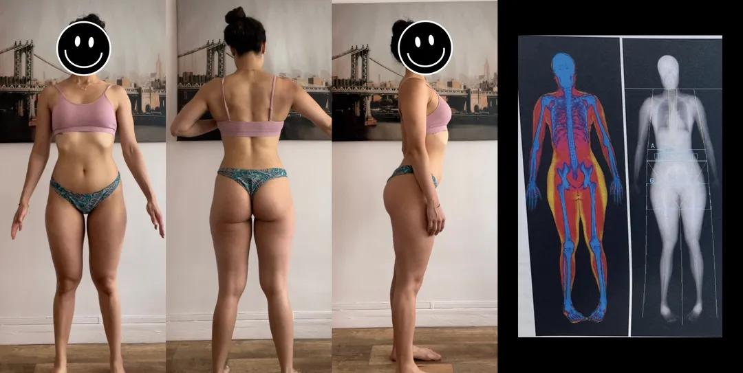 Photos d'une femme à côté de ses résultats de scan DA, qui permet d'estimer et de visualiser la masse grasse avec une assez bonne précision.