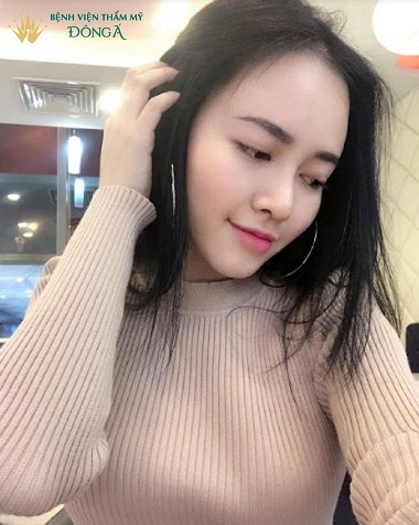 Nâng mũi tự nhiên Webtretho | Chị em REVIEW địa chỉ nâng mũi - Hình 8