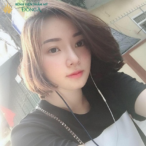 Nâng mũi tự nhiên Webtretho | Chị em REVIEW địa chỉ nâng mũi - Hình 9