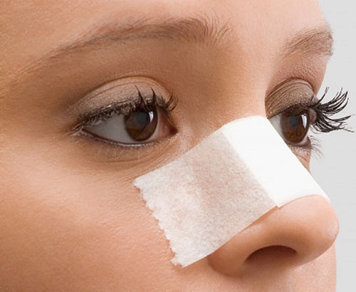 Nâng mũi mấy ngày tháo băng? Có nên tự tháo băng tại nhà không? Hình 3
