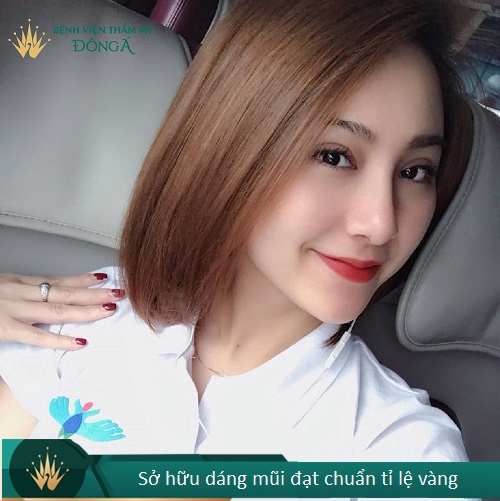 Nâng mũi bán cấu trúc - 7 Thông tin cần thiết cho Tín Đồ Làm Đẹp - Hình 4
