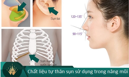 Nâng mũi bán cấu trúc - 7 Thông tin cần thiết cho Tín Đồ Làm Đẹp - Hình 6
