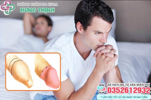 Bao quy đầu dài có nên cắt không?