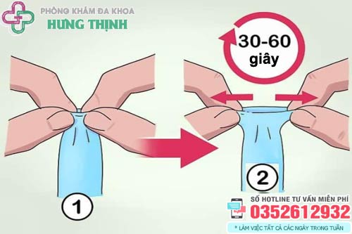 Cách lột bao quy đầu tại nhà