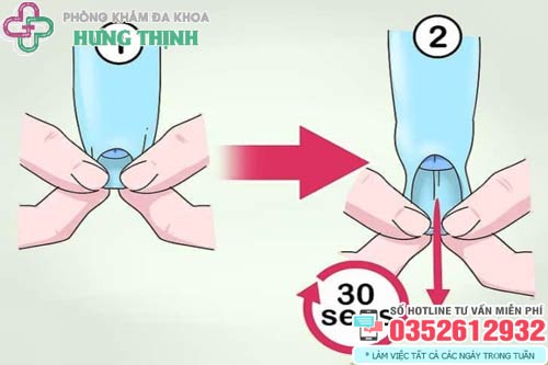 Cách lột bao quy đầu dài tại nhà