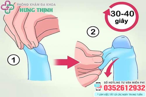 Cách lột bao quy đầu cho trẻ