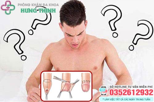 Không cắt bao quy đầu có sao không?