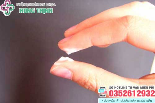 Ra khí hư màu trắng sữa không mùi không ngứa