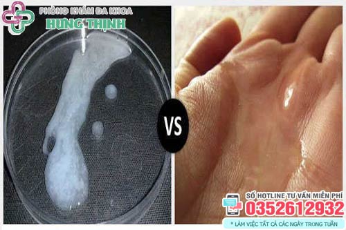 Dịch nhờn của nam giới có chứa tinh trùng không?