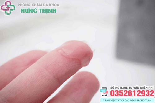 Chất nhờn của nam giới có tinh trùng không?