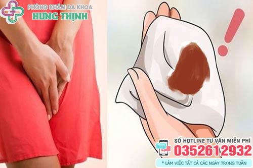 Ra khí hư màu nâu trước kỳ kinh nguyệt