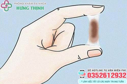 Ra khí hư màu nâu đen trước kỳ kinh nguyệt