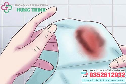 Khí hư màu nâu đỏ trước kỳ kinh nguyệt