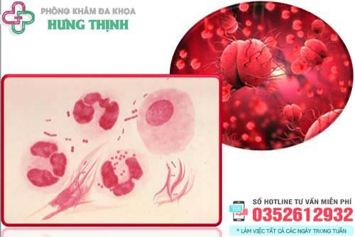 Bệnh lậu là gì?