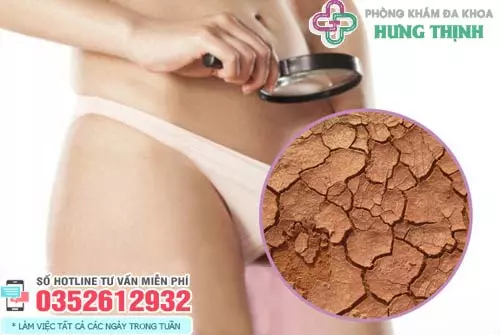 Nguyên nhân cô bé bị khô hạn