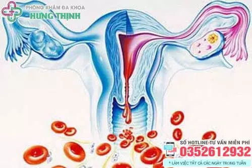 Hiện tượng rong kinh là gì?