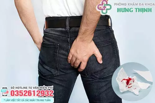 Triệu chứng ngứa hậu môn