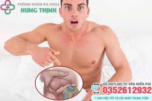 Tư vấn điều trị bệnh lậu
