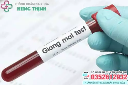 Xét nghiệm giang mai như thế nào?
