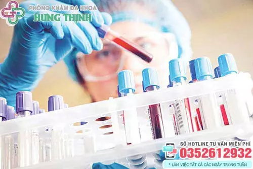Xét nghiệm chẩn đoán bệnh giang mai