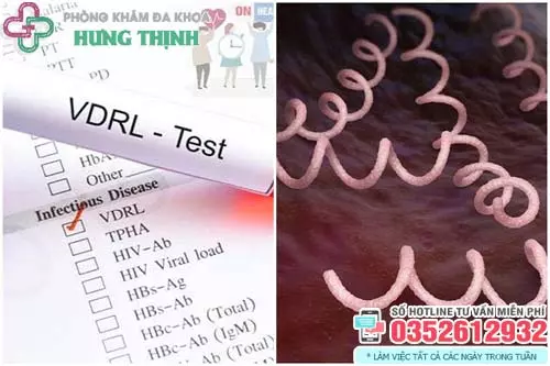 Xét nghiệm giang mai sau bao lâu thì chính xác
