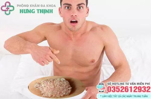 Bệnh sùi mào gà có chữa khỏi được không?