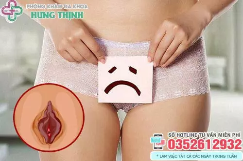 Hình ảnh cô bé bị thâm