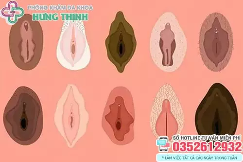 Hình ảnh bị thâm vùng kín