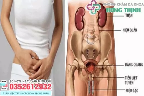 Triệu chứng bệnh viêm đường tiết niệu