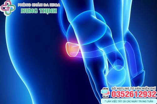 Hình ảnh bệnh viêm tuyến tiền liệt