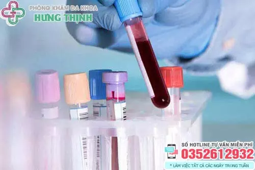Xét nghiệm bệnh xã hội
