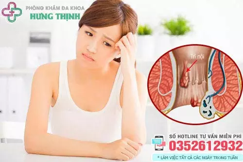 Dấu hiệu bệnh trĩ ở phụ nữ