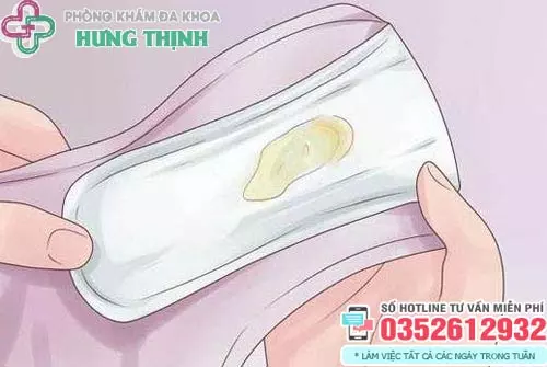 Khí hư ra quần lót có màu vàng