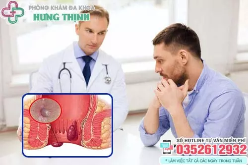 Bác sĩ chữa trĩ giỏi ở Hà Nội