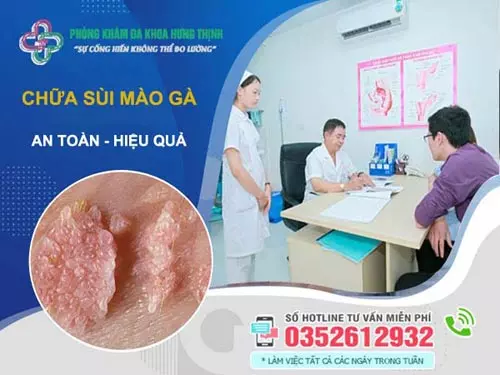 Chữa sùi mào gà tại PK Hưng Thịnh