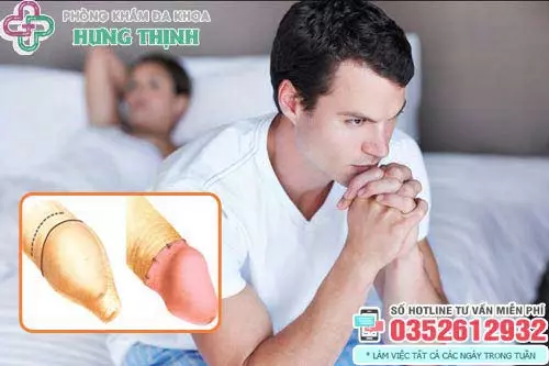 Cắt bao quy đầu bao lâu thì lành vết thương