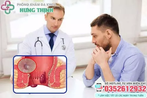 Bệnh trĩ có trị dứt điểm được không?