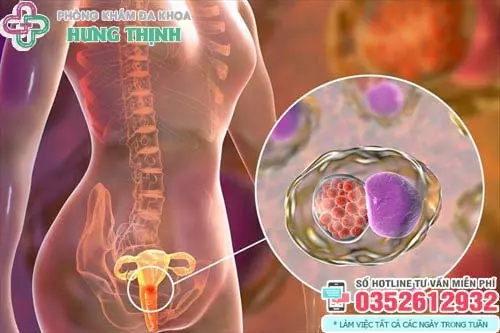 Bệnh lậu có gây vô sinh không?