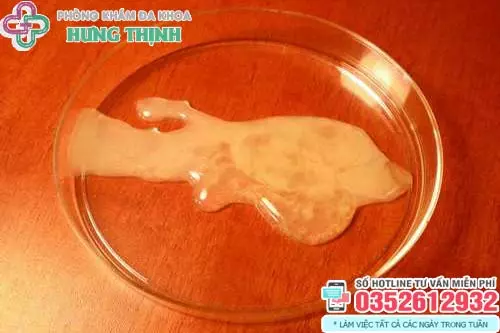 Tinh trùng màu vàng có làm sao không?