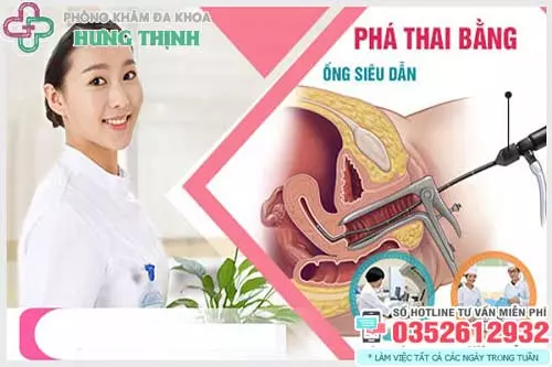 Chi phí phá thai bằng ống siêu dẫn bao nhiêu tiền