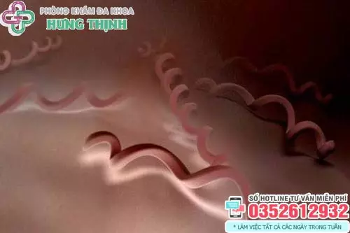 Thời gian ủ bệnh giang mai là bao lâu?