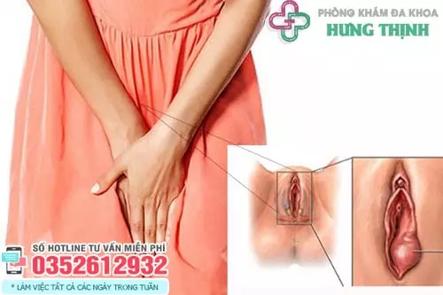 Môi lớn bị sưng 1 bên đau rát và ngứa