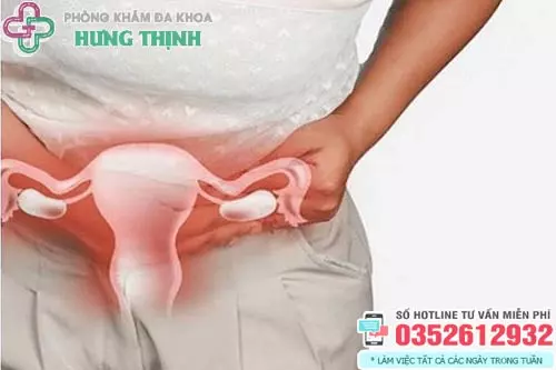 Triệu chứng bệnh viêm vùng chậu