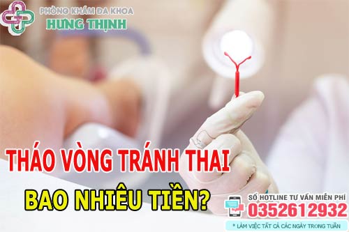 Chi phí tháo vòng tránh thai bao nhiêu tiền