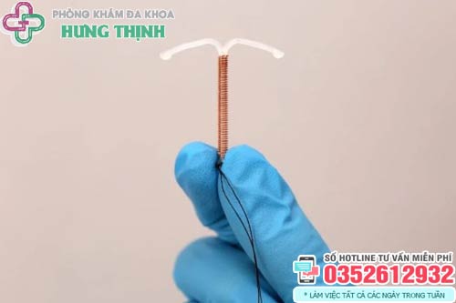 Tháo vòng tránh thai